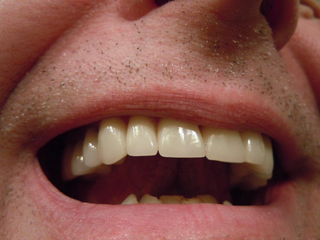 close up picture of a man's teeth
