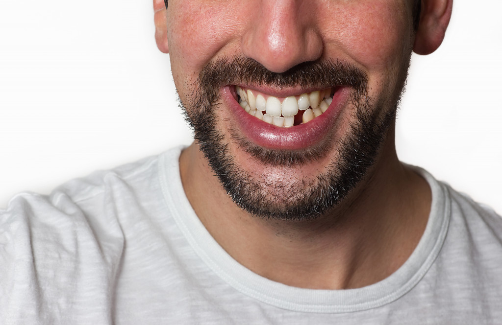 smiling man with a missing tooth