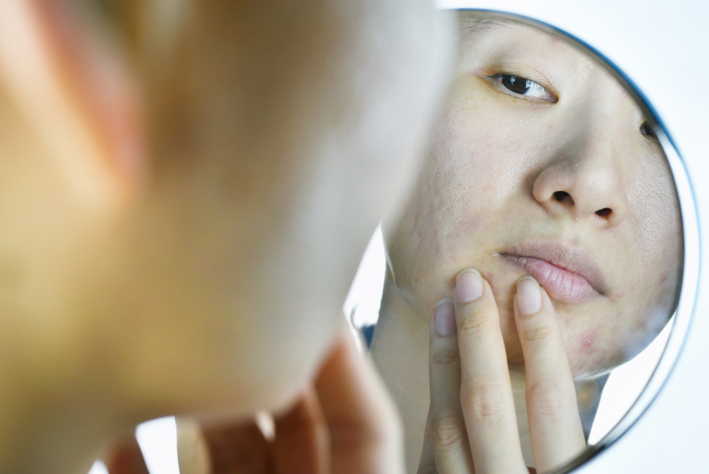 woman having skin problems looking on the mirror